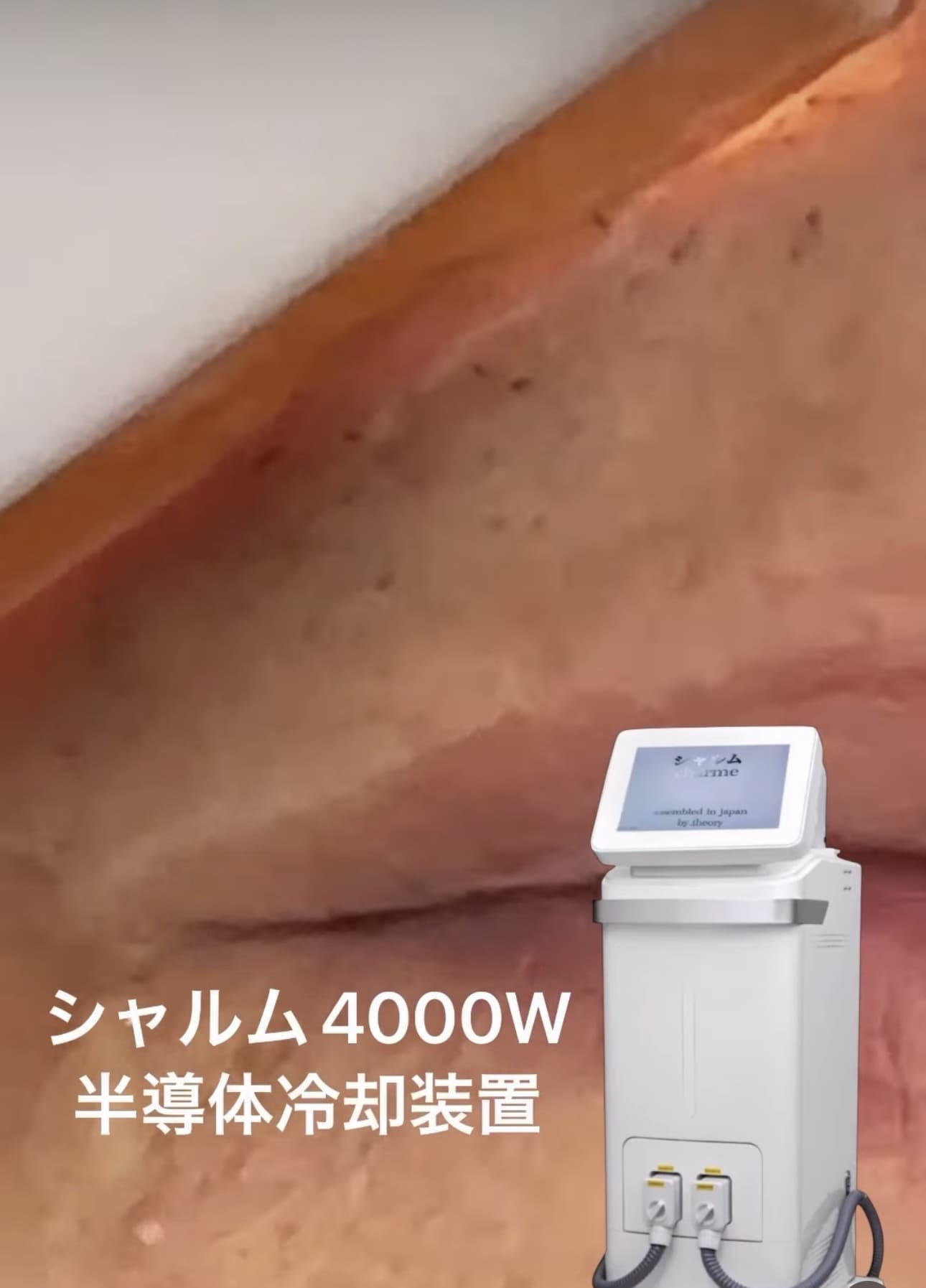 シャルム脱毛機